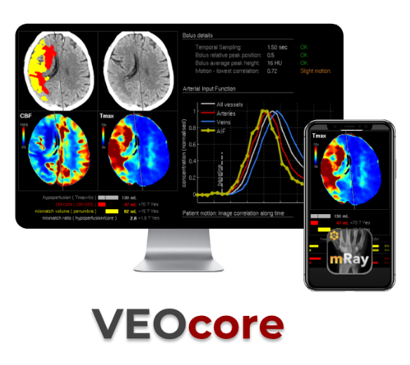 Logo der Firma VEObrain GmbH